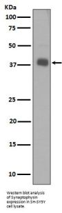 Anti-Synaptophysin SYP Rabbit Monoclonal Antibody