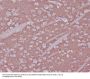 Anti-Synaptophysin SYP Rabbit Monoclonal Antibody