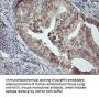 Anti-MSI1 Mouse Monoclonal Antibody [Clone ID: OTI1G8]
