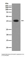 Anti-Musashi 1 MSI1 Rabbit Monoclonal Antibody