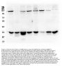 Anti-AMPK beta 2 PRKAB2 Antibody Picoband® (monoclonal, 6G1)