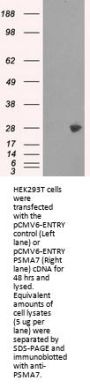Anti-PSMA7 Mouse Monoclonal Antibody [Clone ID: OTI8F9]