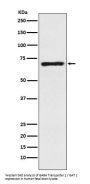 Anti-SLC6A1 / GAT1 Rabbit Monoclonal Antibody
