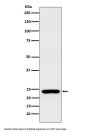 Anti-Rab25 Rabbit Monoclonal Antibody