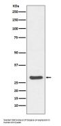 Anti-Caspase-14 Rabbit Monoclonal Antibody