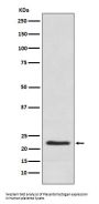Anti-Placental lactogen CSH1 Monoclonal Antibody