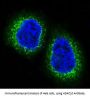 Anti-HDAC10 Rabbit Monoclonal Antibody