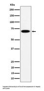 Anti-SLC27A4 Rabbit Monoclonal Antibody