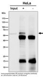 Anti-SLC27A4 Rabbit Monoclonal Antibody