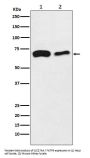 Anti-SLC27A4 / FATP4 Rabbit Monoclonal Antibody