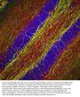 Anti-Neurofilament NF-H NEFH Antibody