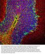 Anti-Phosphorylated Neurofilament NF-H NEFH Antibody