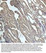 Anti-beta I Tubulin TUBB1 Rabbit Monoclonal Antibody
