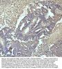Anti-beta I Tubulin TUBB1 Rabbit Monoclonal Antibody