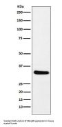 Anti-CRALBP RLBP1 Monoclonal Antibody