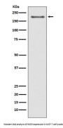 Anti-NSD3/WHSC1L1 Rabbit Monoclonal Antibody
