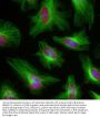 Anti-Beta-tubulin TUBB4A Monoclonal Antibody