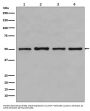 Anti-beta Tubulin TUBB Rabbit Monoclonal Antibody