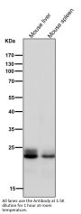 Anti-Rab9 RAB9A Rabbit Monoclonal Antibody