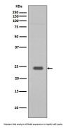 Anti-Rab9 RAB9A Rabbit Monoclonal Antibody