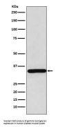 Anti-gamma Sarcoglycan Rabbit Monoclonal Antibody
