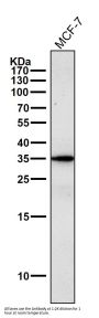 Anti-gamma Sarcoglycan Rabbit Monoclonal Antibody