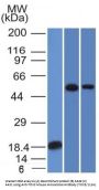 Anti-TOX3 / TNRC9 Monoclonal Antibody