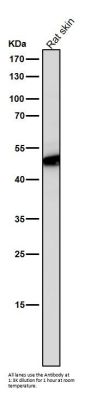 Anti-Flotillin 2 FLOT2 Rabbit Monoclonal Antibody