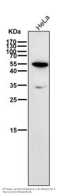 Anti-HDAC11/Histone Deacetylase 11 Rabbit Monoclonal Antibody