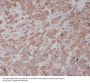 Anti-Tubulin gamma Rabbit Monoclonal Antibody