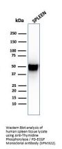 Anti-Thymidine Phosphorylase / PD-ECGF (Angiogenesis Marker) Monoclonal Antibody