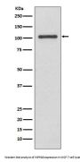 Anti-INPP4B/Type Ii 4 Phosphatase Rabbit Monoclonal Antibody