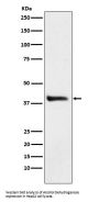 Anti-Alcohol Dehydrogenase Rabbit Monoclonal Antibody