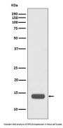Anti-RPS20/Ribosomal Protein S20 Rabbit Monoclonal Antibody