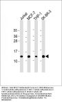 Anti-RPS27 Antibody (N-Term)