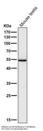 Anti-PI 3 Kinase p55 gamma PIK3R3 Rabbit Monoclonal Antibody