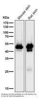 Anti-Cytokeratin 15 Rabbit Monoclonal Antibody
