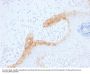 Anti-Cytokeratin 15 (KRT15) (Basal Cell Marker) Monoclonal Antibody