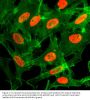 Anti-Acetyl-Histone H3 (Lys14) H3F3A Rabbit Monoclonal Antibody, Clone#RM130