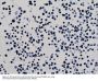 Anti-Acetyl-Histone H3 (Lys9) H3F3A Rabbit Monoclonal Antibody, Clone#RM161