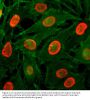 Anti-Acetyl-Histone H3 (Lys9) H3F3A Rabbit Monoclonal Antibody, Clone#RM161