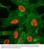 Anti-Acetyl-Histone H3 (Lys27) H3F3A Rabbit Monoclonal Antibody, Clone#RM172