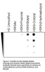 Anti-Crotonyl-Histone H3 (Lys9) H3F3A Rabbit Monoclonal Antibody, Clone#RM339