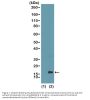 Anti-Monomethyl-Histone H3 (Lys4) H3F3A Rabbit Monoclonal Antibody, Clone#RM140