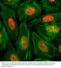 Anti-Monomethyl-Histone H3 (Lys4) H3F3A Rabbit Monoclonal Antibody, Clone#RM140