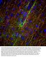 Anti-Neurofilament Medium NF-M Monoclonal Antibody