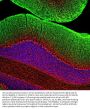 Anti-Neurofilament NF-M Antibody