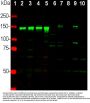 Anti-Neurofilament NF-M Antibody