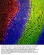 Anti-Neurofilament NF-M Antibody