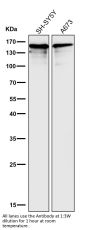 Anti-NEFM/Nf M Rabbit Monoclonal Antibody